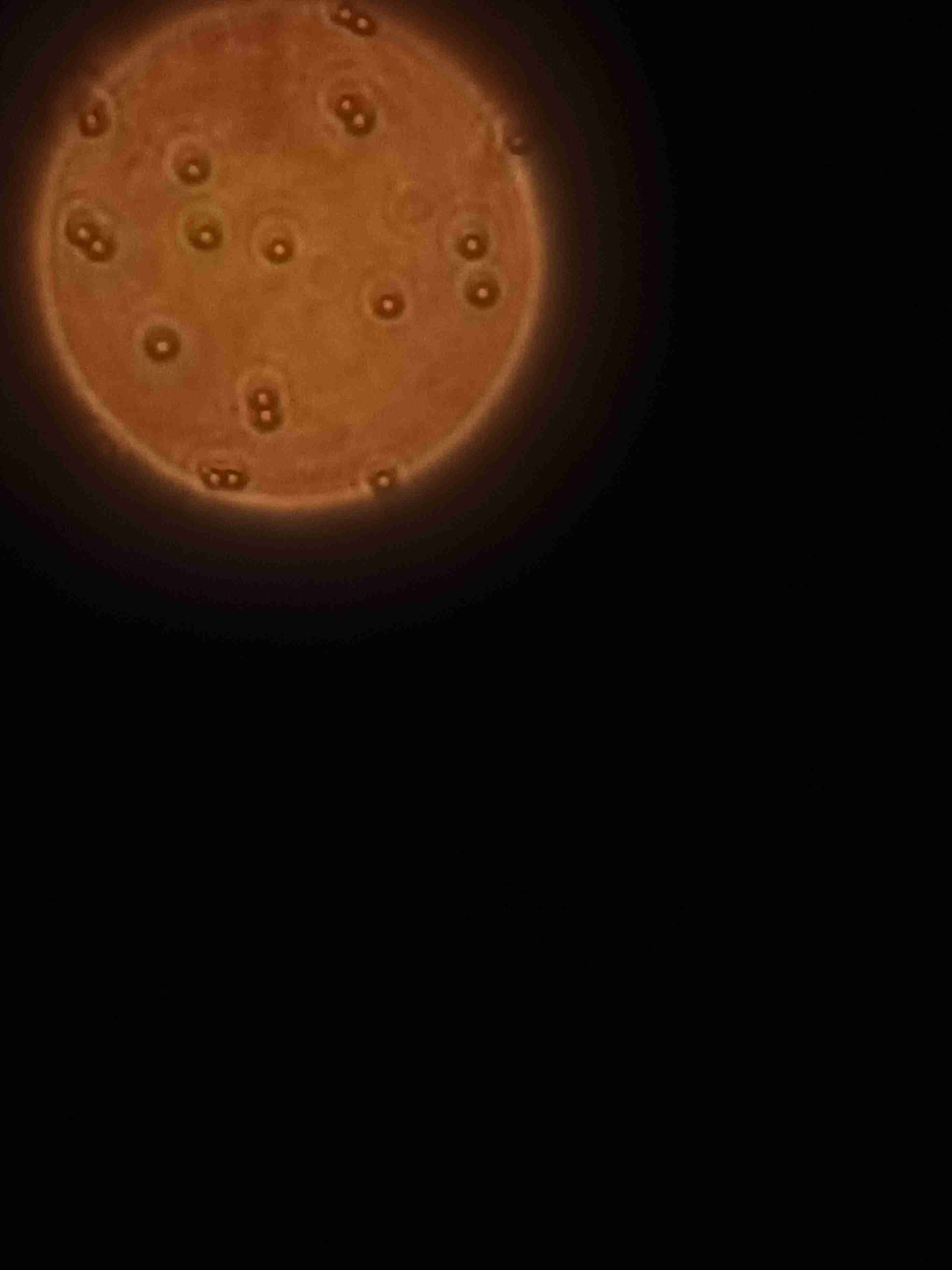 Super Resolution Imaging using Fluorescence Spectroscopy 3